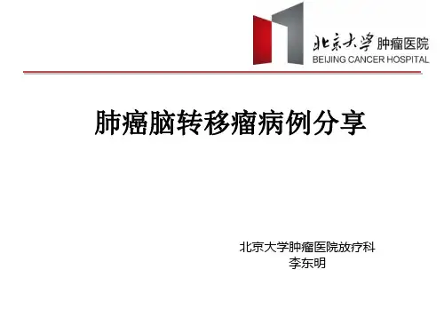 脑转移瘤病例
