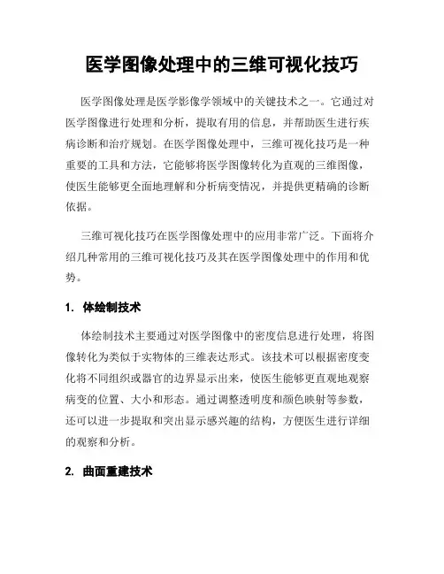 医学图像处理中的三维可视化技巧