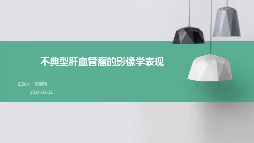 不典型肝血管瘤的影像学表现