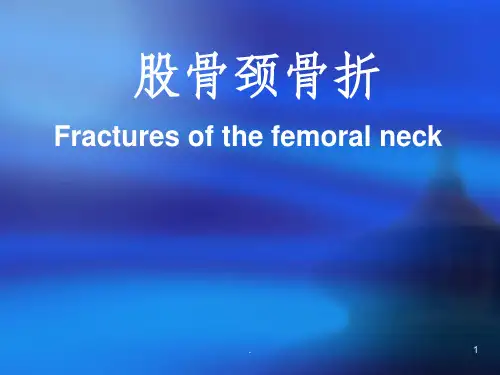 股骨颈骨折ppt课件