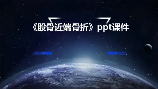 《股骨近端骨折》课件