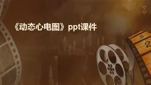《动态心电图》课件