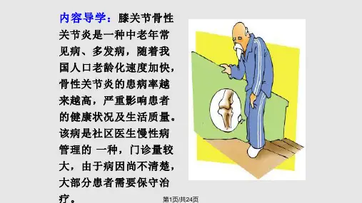 膝关节骨性关节炎ppt课件PPT课件