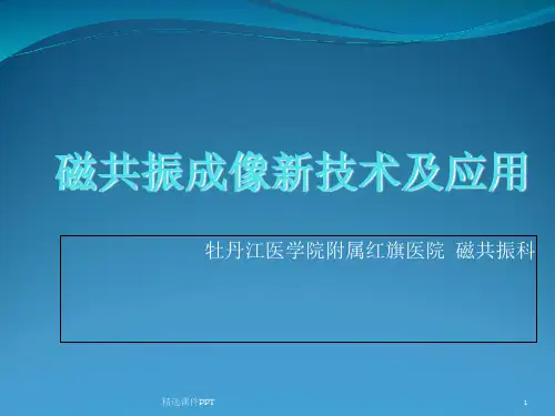 磁共振新技术ppt课件