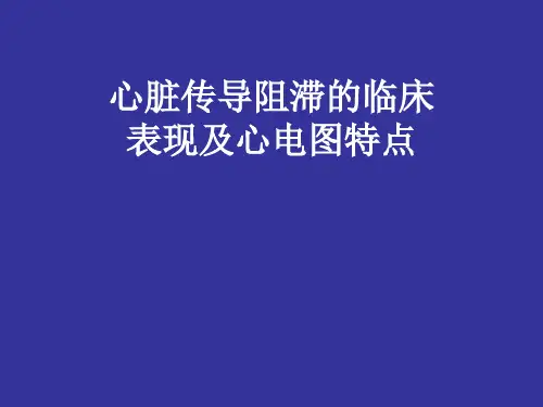 心脏传导阻滞的临床表现及心电图特点(50页)