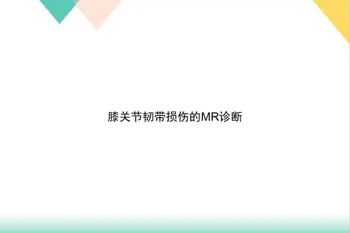 膝关节韧带损伤的MR诊断PPT.