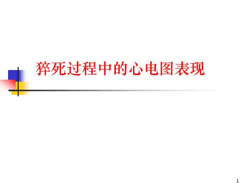猝死过程中的心电图表现PPT课件