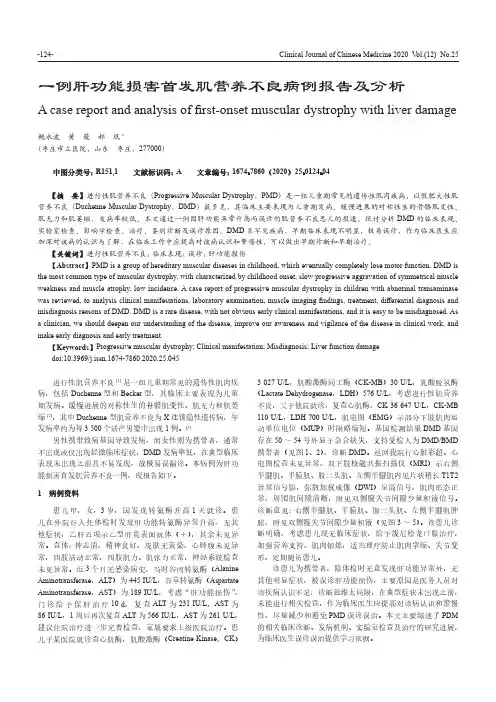 一例肝功能损害首发肌营养不良病例报告及分析