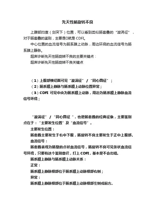 先天性肠旋转不良