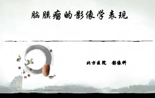 脑膜瘤的影像诊断、病理分型及波谱表现