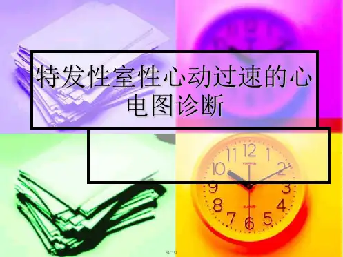 特发性室性心动过速的心电图诊断