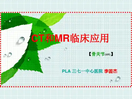 骨关节MR应用