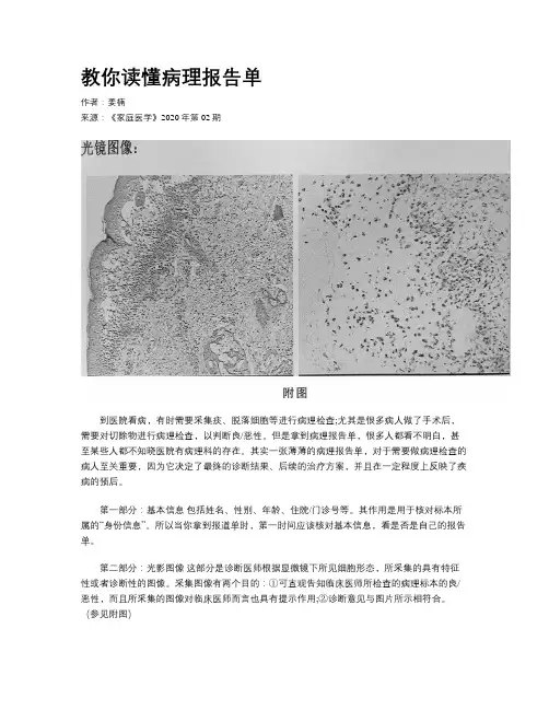 教你读懂病理报告单