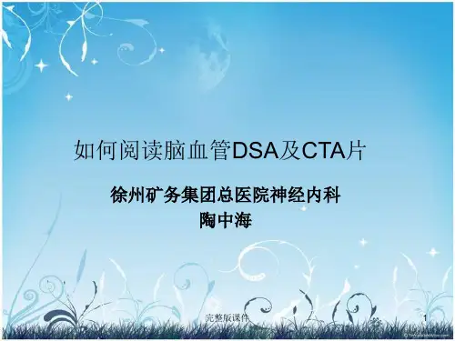 脑血管造影及CTAppt课件