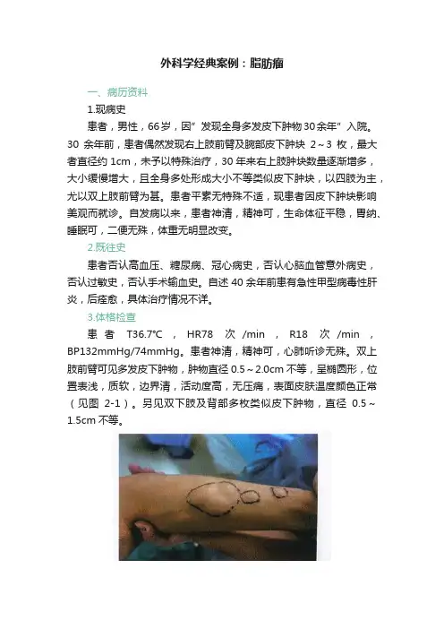 外科学经典案例：脂肪瘤