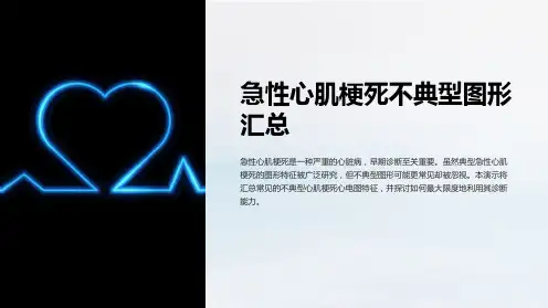 急性心肌梗死不典型图形汇总