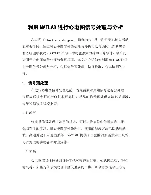 利用MATLAB进行心电图信号处理与分析