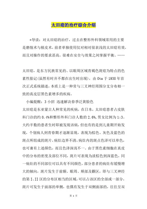 太田痣的治疗综合介绍