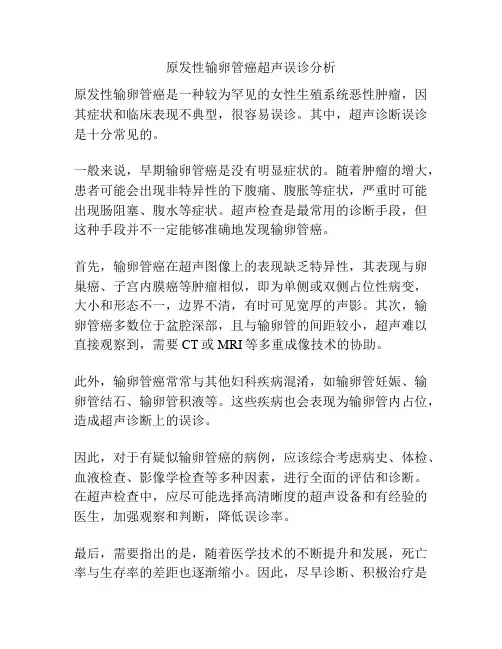 原发性输卵管癌超声误诊分析