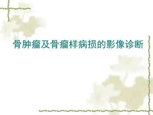 骨肿瘤及骨瘤样病损的影像诊断