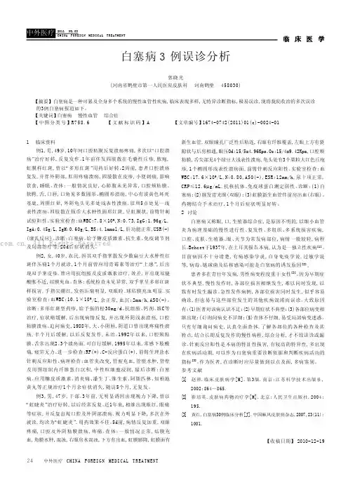 白塞病3例误诊分析
