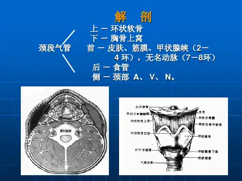 气管切开术及其配合ppt课件