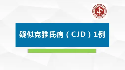 克雅氏病