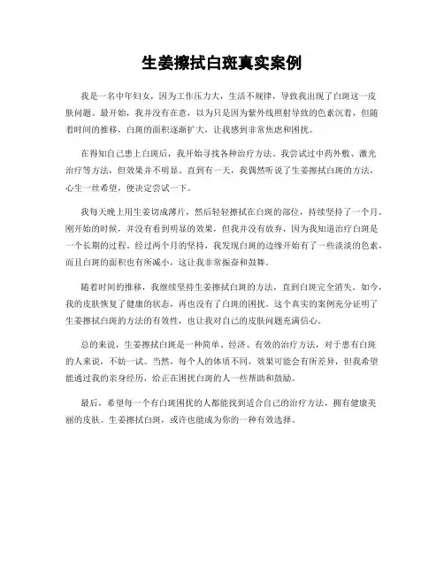 生姜擦拭白斑真实案例