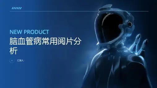 脑血管病常用阅片分析