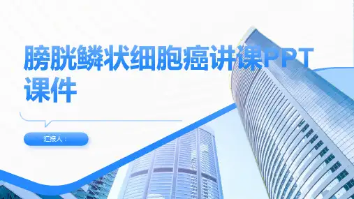膀胱鳞状细胞癌讲课PPT课件