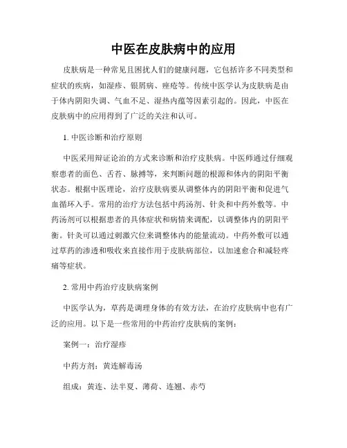 中医在皮肤病中的应用