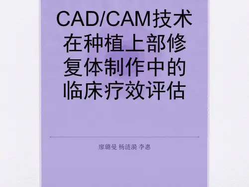 CADCAM在口腔种植上的应用