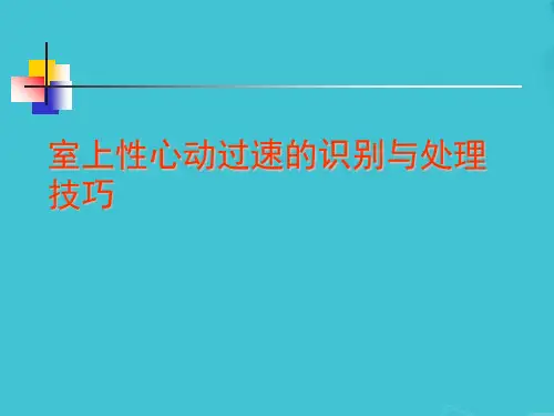 室上性心动过速的识别与处理技巧
