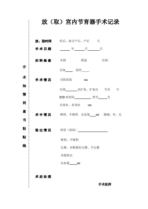 放取环同意书