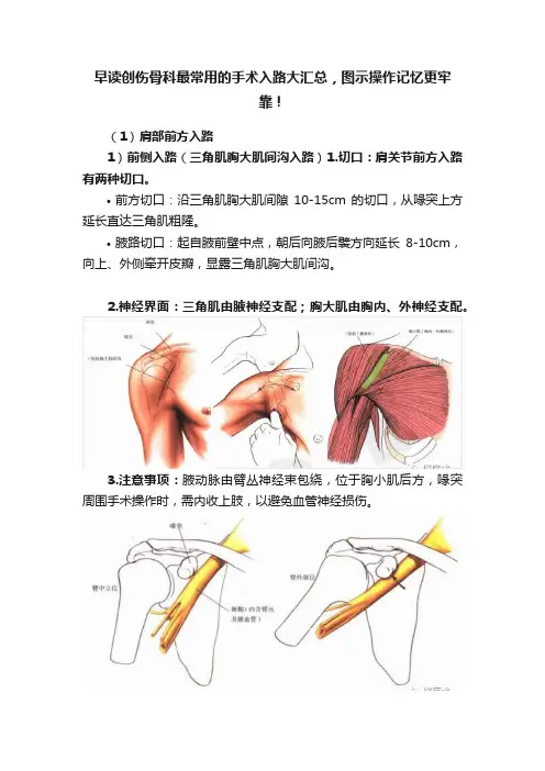 早读创伤骨科最常用的手术入路大汇总，图示操作记忆更牢靠！