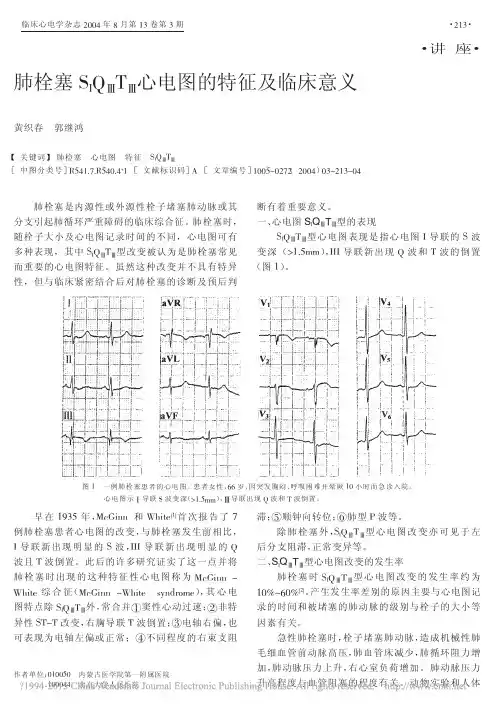 肺栓塞S_IQ_T_心电图的特征及临床意义_黄织春
