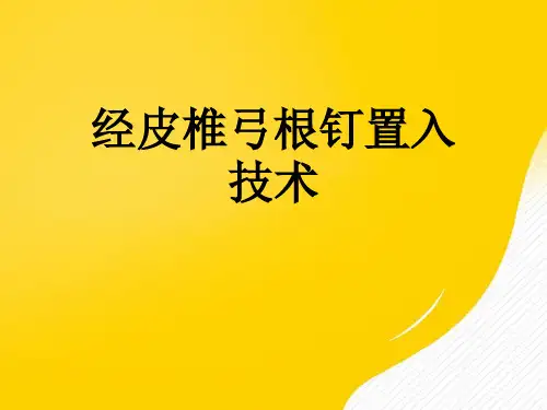 【优秀文档】经皮椎弓根钉置入技术PPT