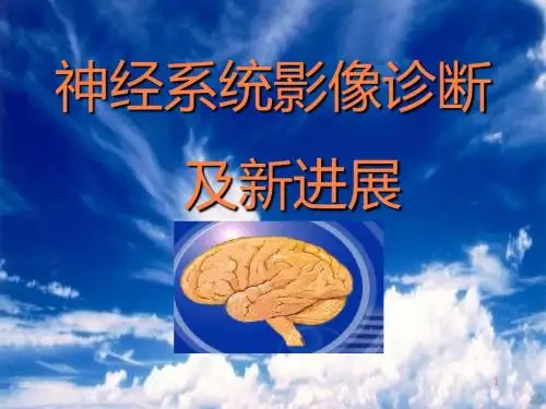 神经系统影象诊断PPT课件
