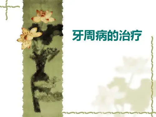 牙周病的治疗