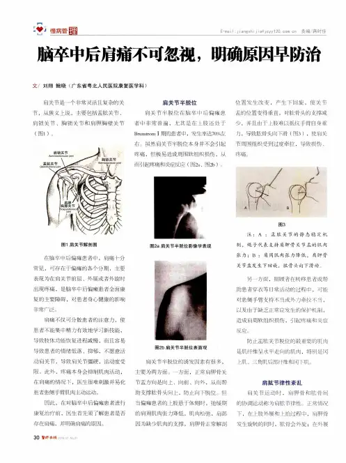 脑卒中后肩痛不可忽视,明确原因早防治