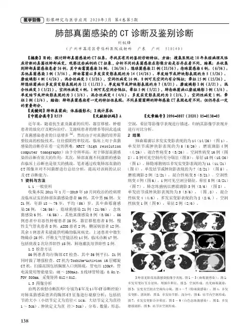 肺部真菌感染的ct诊断及鉴别诊断