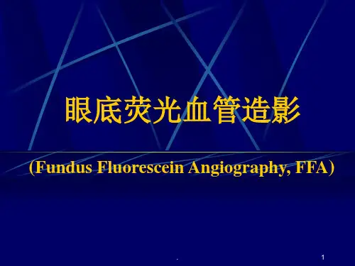 眼底荧光血管造影课件