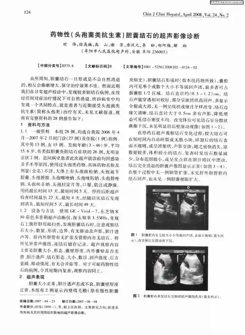药物性(头孢菌类抗生素)胆囊结石的超声影像诊断