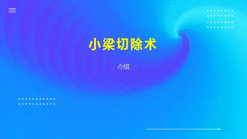 小梁切除术 