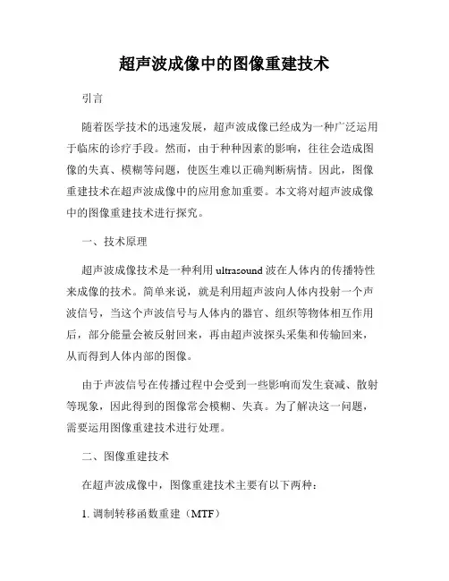 超声波成像中的图像重建技术