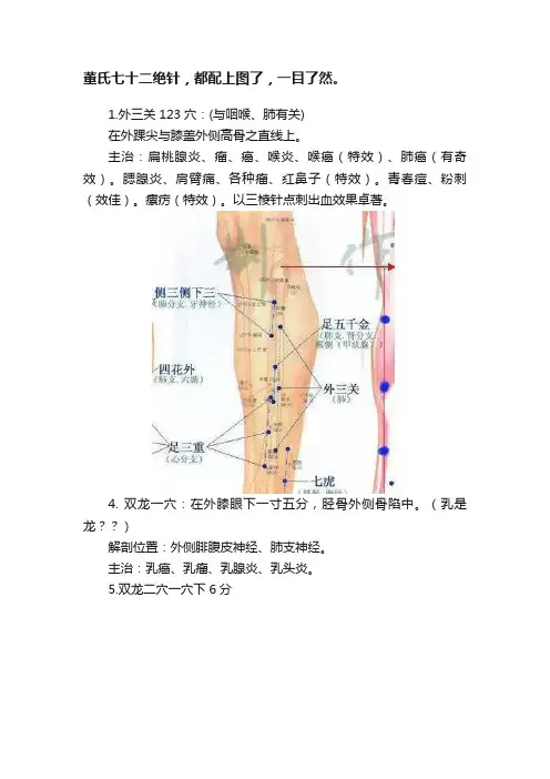 董氏七十二绝针，都配上图了，一目了然。