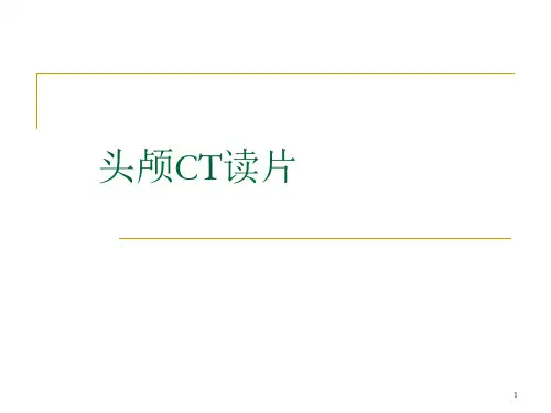 头颅CT读片PPT演示课件