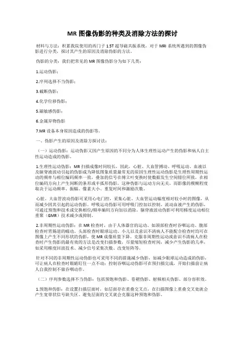 MR图像伪影的种类及消除方法的探讨