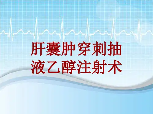 手术讲解模板：肝囊肿穿刺抽液乙醇注射术