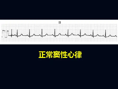 心律失常识别与治疗-PPT文档